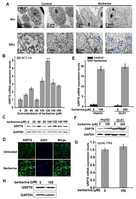 GRP78 Was Elevated In Berberine Treated Cancer Cell Lines A Electron