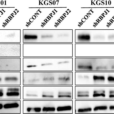 Effects Of Rbpj Knockdown On The Proliferation And Invasiveness Of