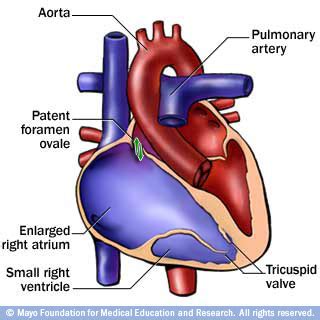 Congenital Heart Disease Flashcards Quizlet