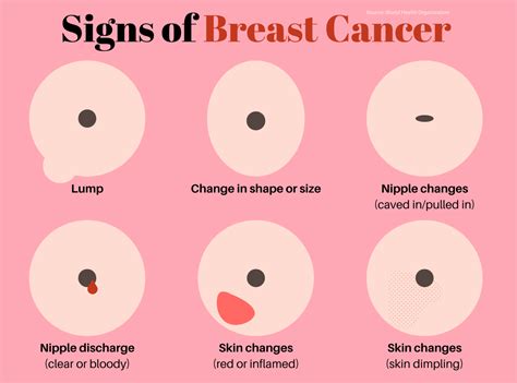 Signs of Breast Cancer by Sreejith V on Dribbble