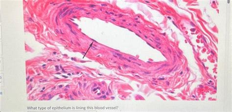 Solved What Type Of Epithelium Is Lining This Blood Vessel