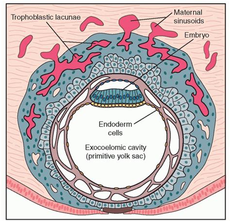 Placenta And Umbilical Cord Radiology Key