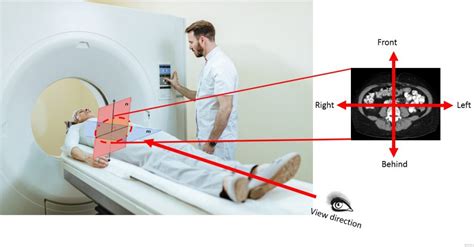 Chest Ct Scan Clincasequest