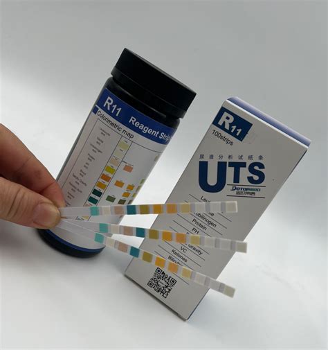 Best Professional Urinalysis Paper Parameters Urinary Infection