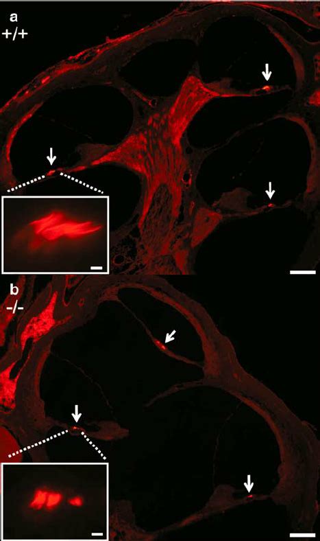 Immunofluorescence Localization Of Prestin In Both The Wild Type