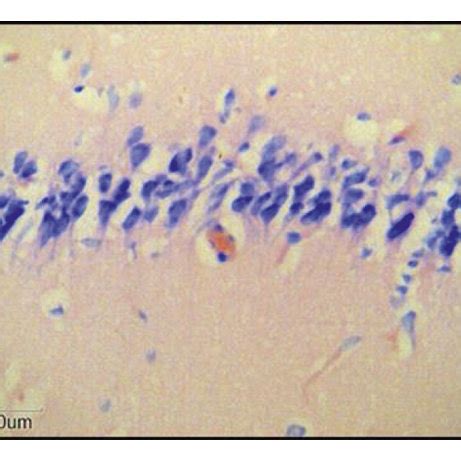 Histological Analysis Of The CA1 Region In Hippocampus Brain Tissue