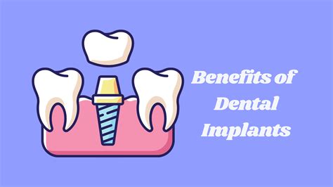 The Benefits Of Dental Implants Healthnord