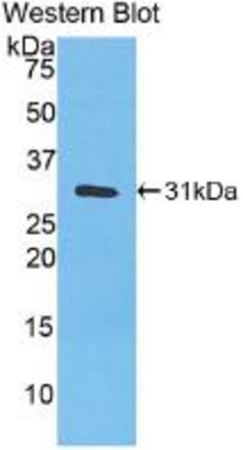 Carbonic Anhydrase III Monoclonal Antibody C2 Invitrogen 20 μL