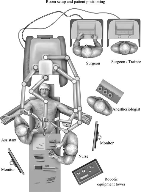 Robotic Assisted Giant Paraesophageal Hernia Repair And Nissen