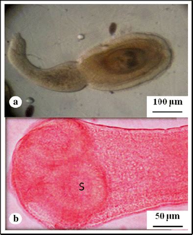 Photomicrographs Of Test Parasite Hymenolepis Diminuta A A Tailed