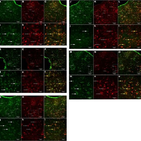 If Of Gb1 And 5 Ht Neurons In The Drn A A B B C C Control Download Scientific