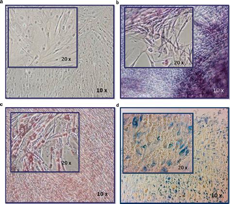 Adipogenic Osteogenic And Chondrogenic Differentiation Of Phlp Cell