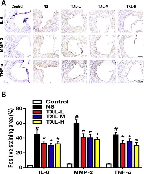 Effects Of Txl On The Expression Of Pro Inflammatory Cytokines Il 6