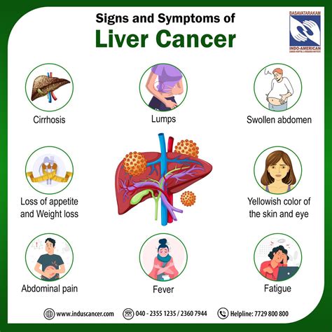 Understanding Liver Cancer Causes Symptoms Prevention And Treatment