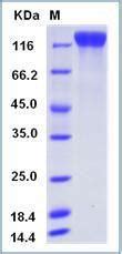 Human Recombinant VEGFR2 Flk 1 CD309 KDR Protein His Tag