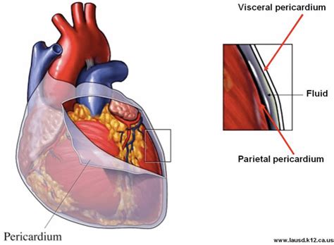 Pericarditis – Core EM