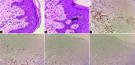 Photomicrographs Of Histopathological And Immunohistochemical Findings Download Scientific