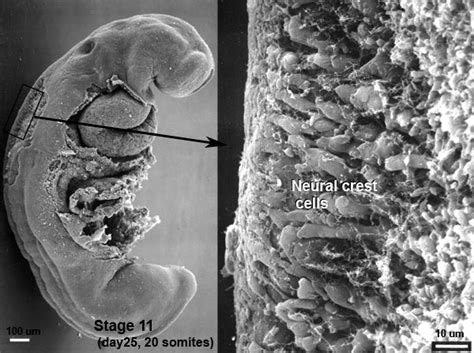 Neural Crest Development Embryology