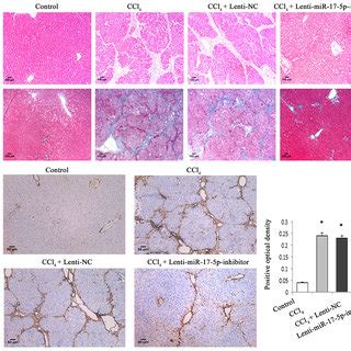 Sal B Significantly Ameliorated CCl 4 Induced Liver Fibrosis In Rats