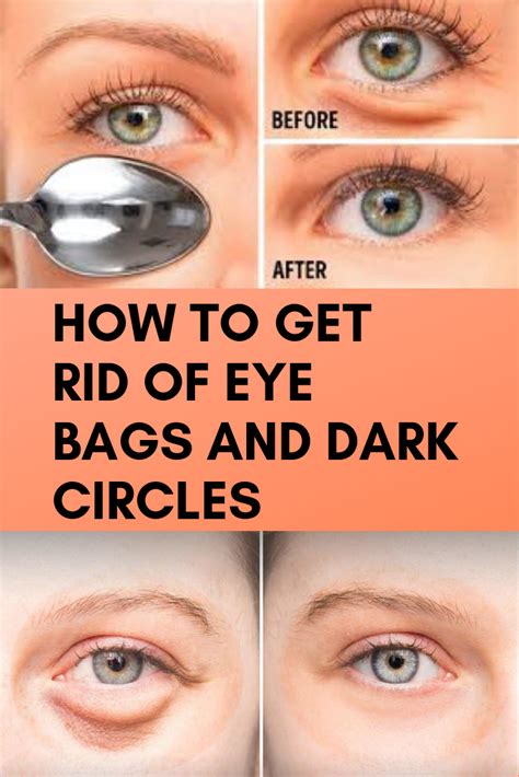 How To Get Rid Eye Bags Howtormeov