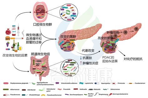 “隐藏高手”胰腺癌的新出路——微生物 中国医疗