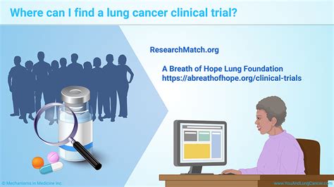 Slide Show Lung Cancer Clinical Trials And The Us Black Community