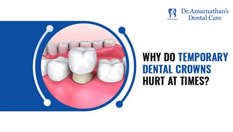 What Are The Factors Behind Temporary Crown Pain