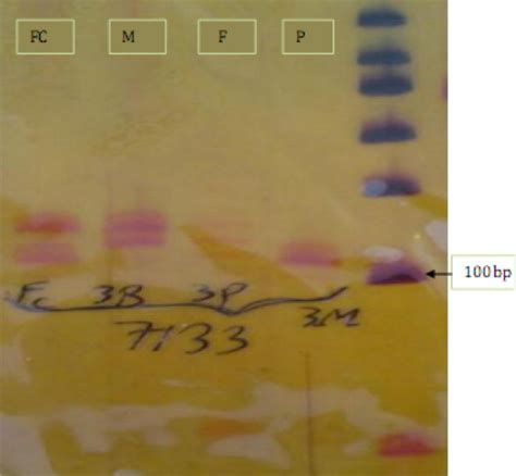 Sex Determination Using Free Fetal Dna At Early Gestational Ages A