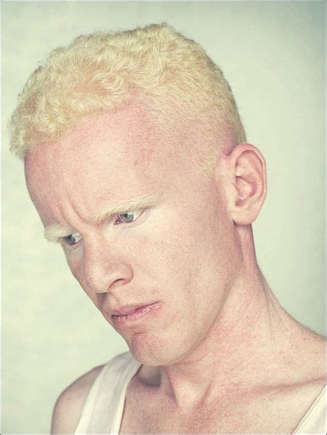 Albinos Project By Gustavo Lacerda Portrait Photography Albino Men Albinism Albino