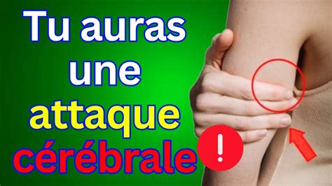 Les Signes Avant Coureurs D Un Accident Vasculaire C R Bral Soyez