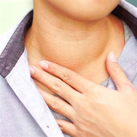 Top 98 Pictures Thyroid Rash On Neck Photos Updated