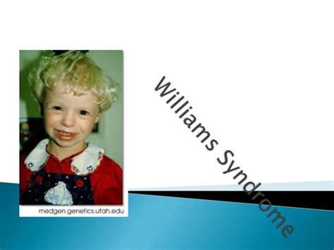 Williams Syndrome Ppt