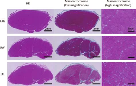 Hematoxylin And Eosin And Massons Trichrome Low And High