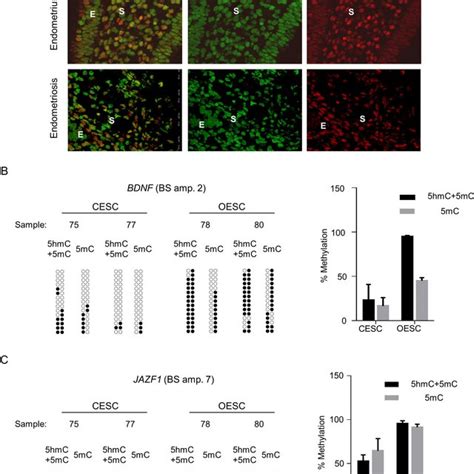 Analysis Of Mc And Hmc In Endometriosis Lesions And Stroma Cells A