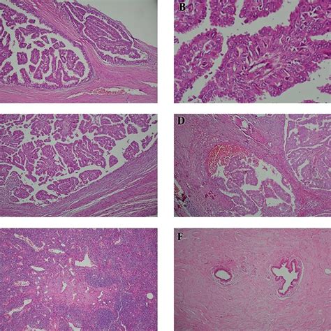 Microscopic Examination Hematoxylin And Eosin Staining Download