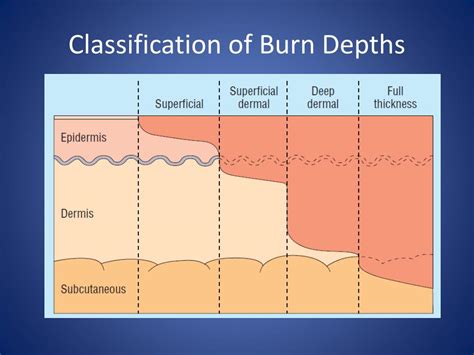 Ppt Burn Pathophysiology Powerpoint Presentation Free Download Id 6076047