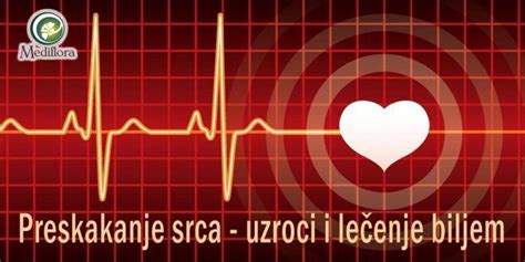 Preskakanje srca uzroci i lečenje biljem Mediflora Cardiac diet