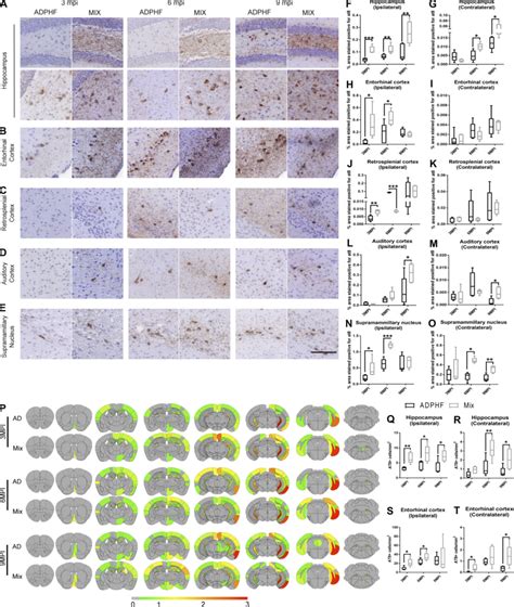 P Tau Pathology Is Enhanced Under Copathology Conditions After Download Scientific Diagram