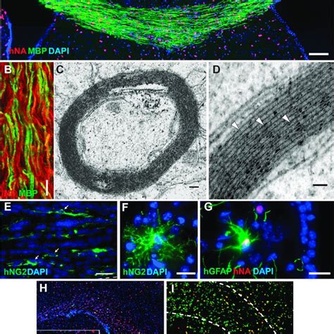 Generation Of Oligodendrocytes From Human Pscs A Diagram Of The