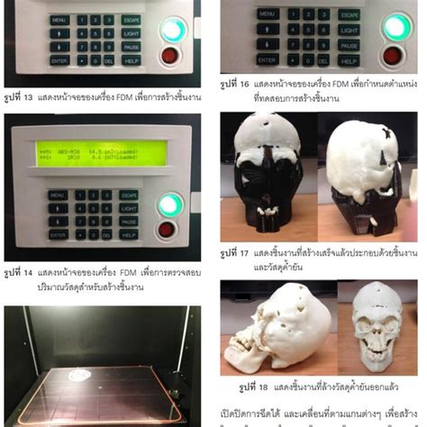 3D of cranio-maxillofacial anatomy | Download Scientific Diagram