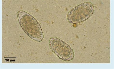 Cattle Helminths Flashcards Quizlet