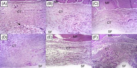 Representative Images Of H E Stained Slides At Days Lower