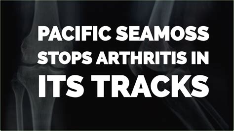 Stop Arthritis In Its Tracks Dr Hugh Butler Series 1 Episode 6 YouTube