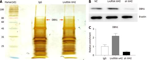 Upregulation Of Long Noncoding Rna W Promotes Tumor Development By