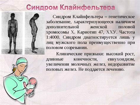 Синдром Клайнфельтера | Справка.Неинвалид.ru