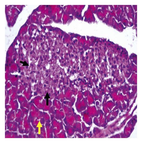 Pancreatic Section From The Normal Control Group Showed Pancreatic