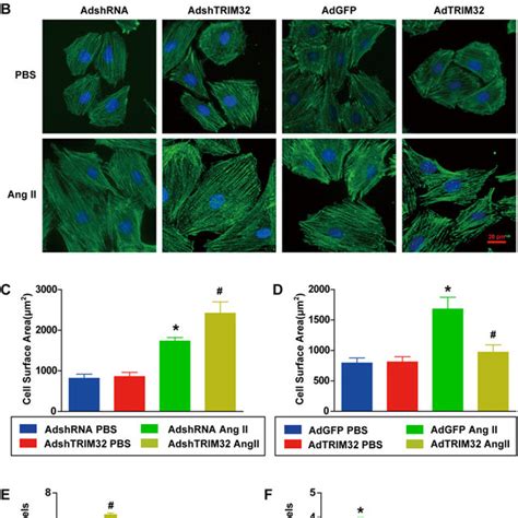 Trim Overexpression Attenuates Pressure Overload Induced Cardiac