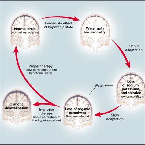 Effects Of Hyponatremia On The Brain And Adaptive Responses Within