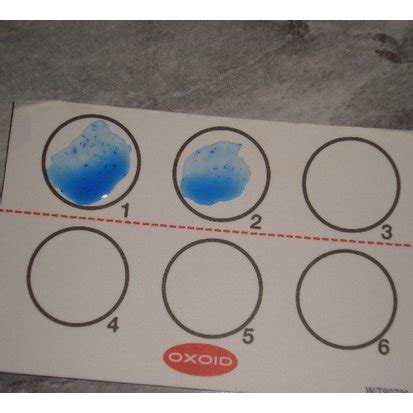 Agglutination Of E Coli O And H Latex Reagent With Isolates