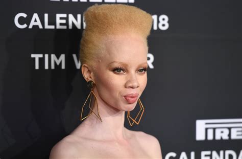 South African Model Thando Hopa Is The First Woman With Albinism To Cover Vogue Aol Lifestyle